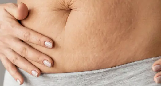 Post pregnancy weight loss