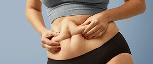 Dealing with Resistant Fat Areas